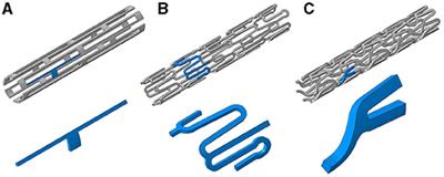 Acute Stent-Induced Endothelial Denudation: Biomechanical Predictors of Vascular Injury